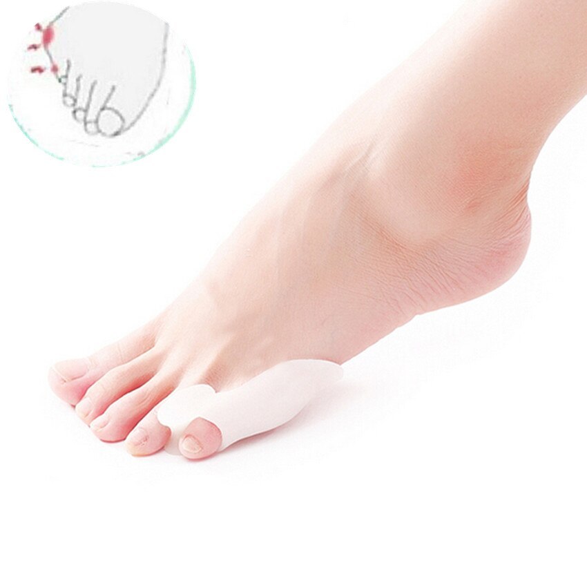 1 pair of silicone small toe straightener