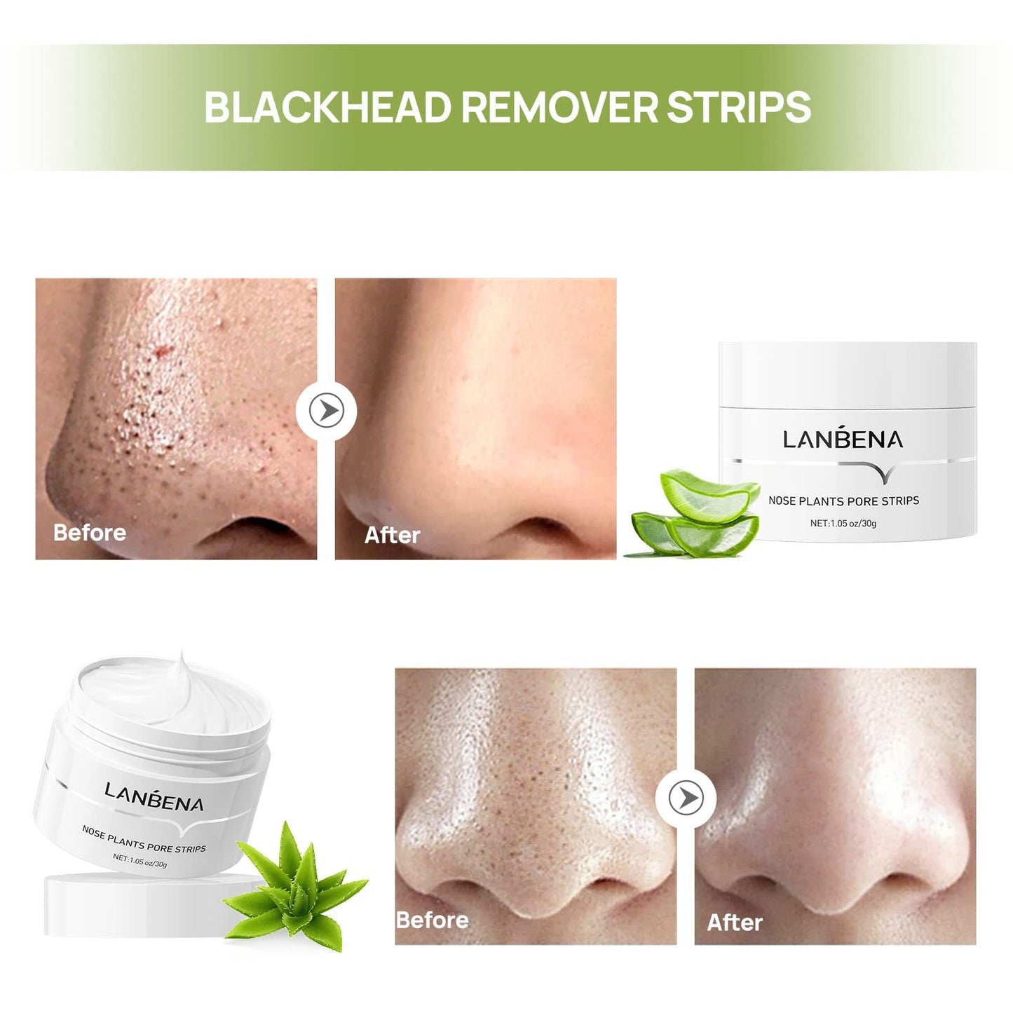 LANBENA Blackhead Mask Pore Strips