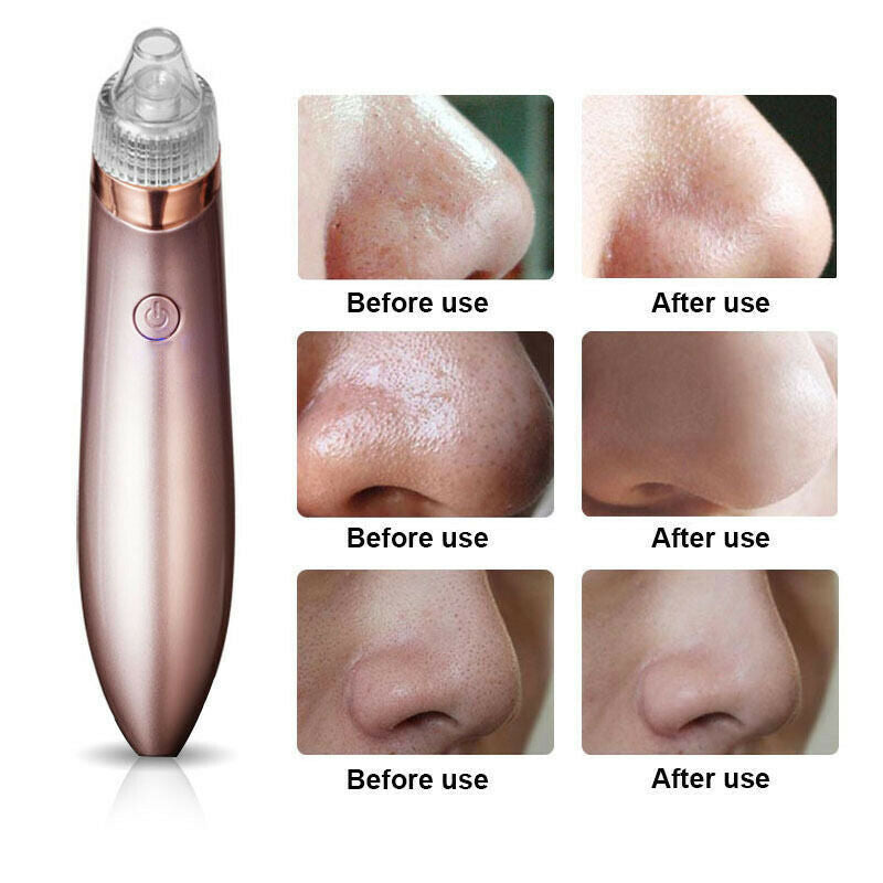 Electric Blackhead Vacuum Pore Cleaner