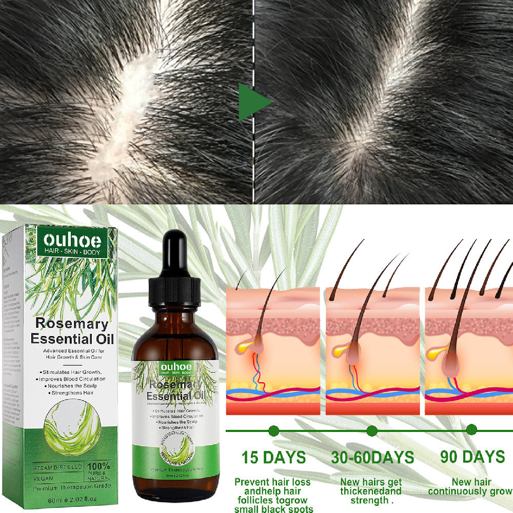 OUHOE Rosemary Hair Care Essential Oil