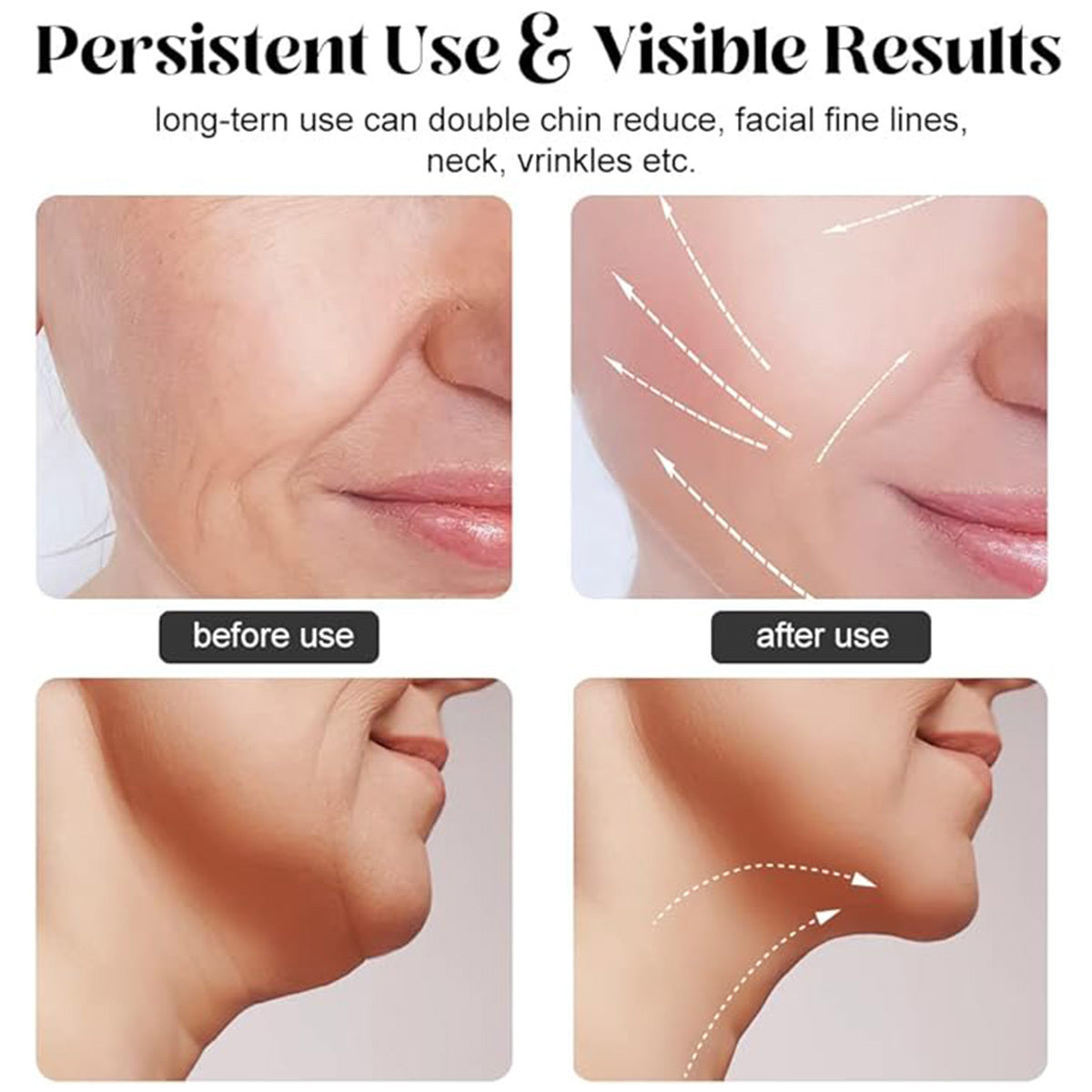 ASEXETIC Neck Face Beauty Device